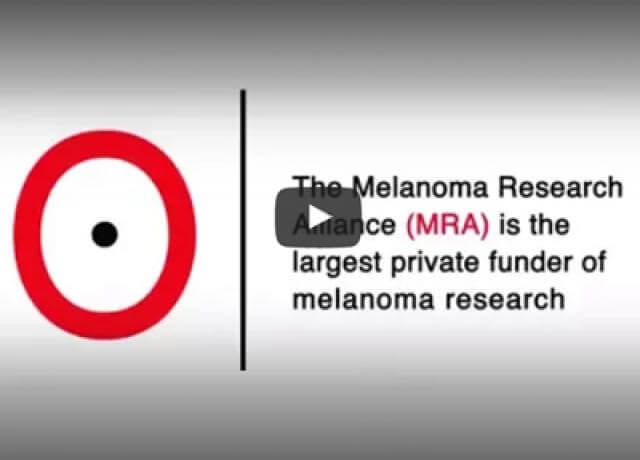 Melanoma video